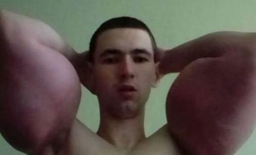 Un joven ruso se inyecta aceite en los brazos para ser como Popeye