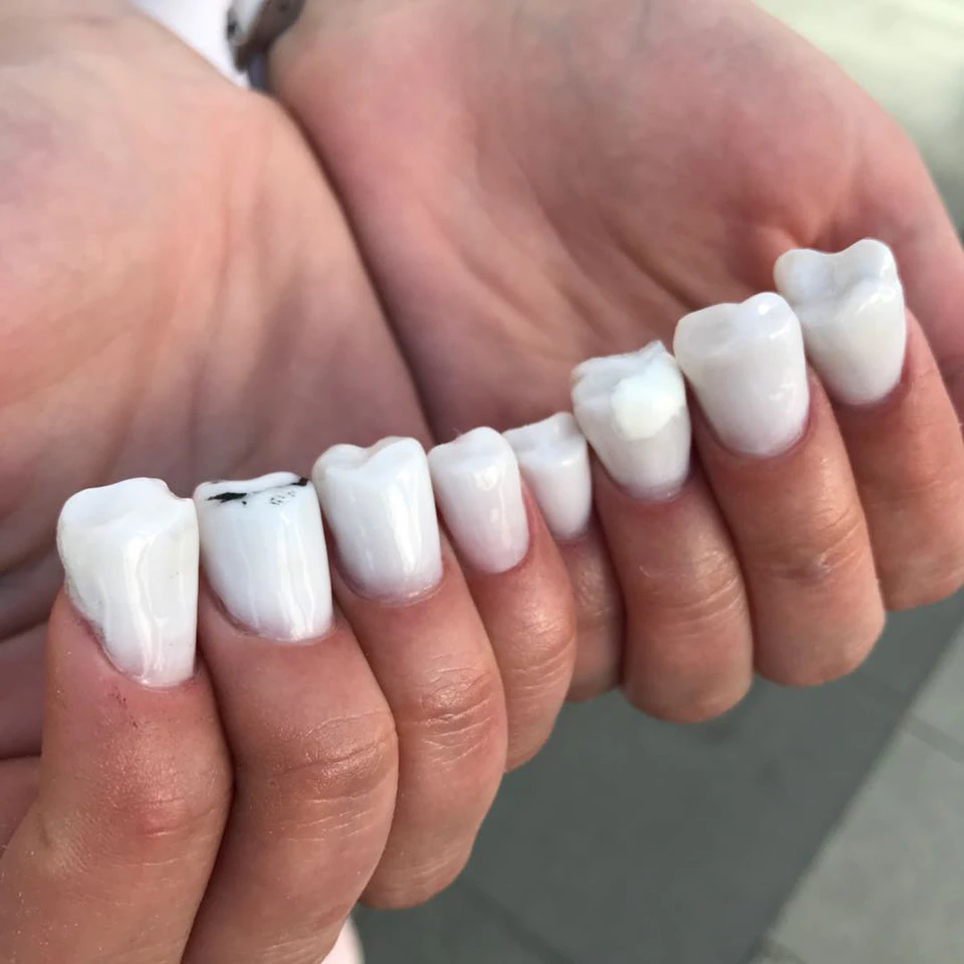 Las uñas con forma de dientes se convierten en la última moda