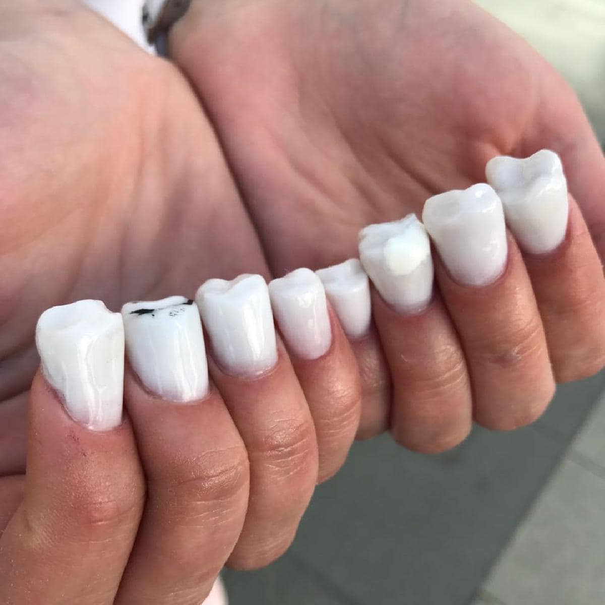 forma de dientes se convierten en la última moda