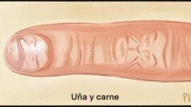 Íntimos. Caso koldo.