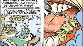Problemas de mordida