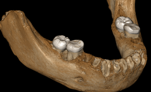 Los denisovanos ya vivían en el Tíbet hace 160.000 años