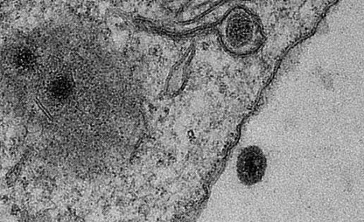 Hallan un nuevo virus con genes totalmente desconocidos