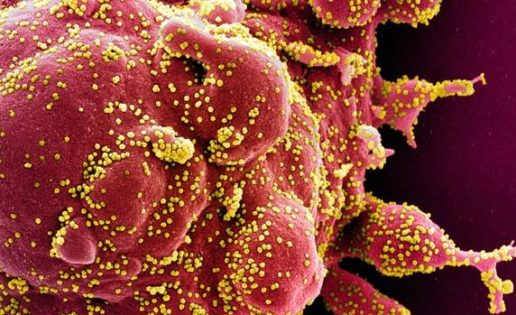 ¿Cómo mata el coronavirus? Los científicos siguen sin saberlo