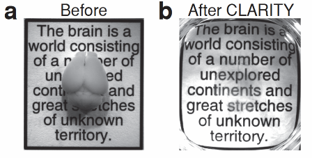 Logran hacer transparente un cerebro para verlo mejor