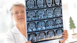 Ana Frank: “Una vida saludable puede retrasar la enfermedad de Alzheimer”