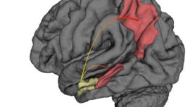 Visualizan los primeros cambios del cerebro con Alzheimer