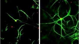 Un fármaco para el corazón frena la esclerosis lateral en ratones