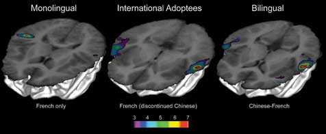 El cerebro de los bebés adoptados conserva la “huella” de su idioma nativo