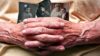 El riesgo de párkinson y alzhéimer se “lee” en la piel