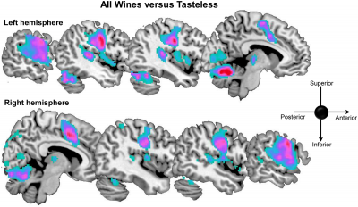 Al cerebro le gusta el vino bajo en alcohol