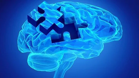 Esclerosis múltiple: «Perder tiempo es perder cerebro»