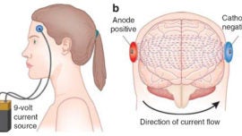 Ictus: Estimulación eléctrica para potenciar la recuperación