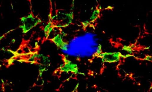 El sistema inmune del cerebro, implicado en el alzhéimer